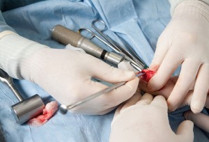 Orthopaedic Surgery