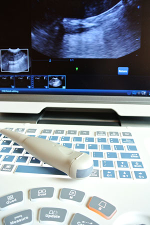 Ultrasonography